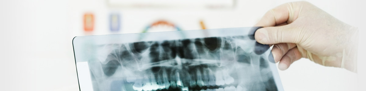 Dental X-Rays