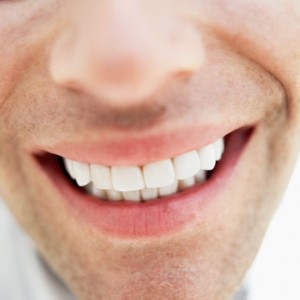 Teeth Whitening in La Habra CA