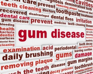 Almost Half of American Adults Have Periodontal Disease