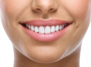 FAQS About Porcelain Veneers