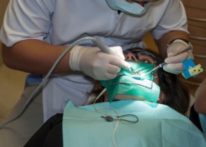 5 Ways to Prevent Root Canal Failure