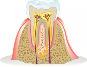 It’s Root Canal Awareness Week