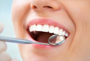 3 Reasons to Schedule an Exam & Cleaning Before Whitening