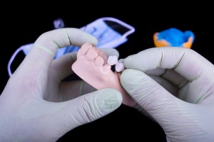 Digital Impressions Make Dental Implants Easier
