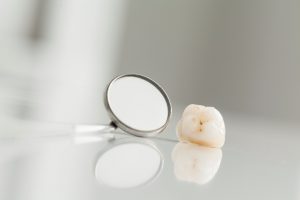 Do You Need a Dental Crown? Find Out the Most Common Reasons People Get Dental Crowns 