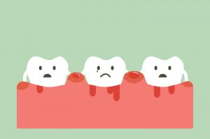 How to Determine if You May Have Gum Disease