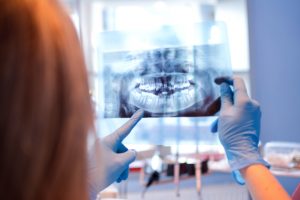 Dental X-Rays Are Nothing to Be Afraid Of: Learn How They Can Help You