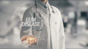 6 of the Most Common Signs That You May Have Gum Disease