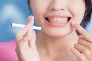 Are Your Teeth Turning Yellow? Learn the Most Common Causes of Yellow Teeth