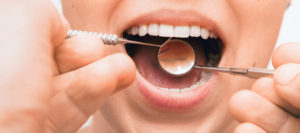 Gingivitis is Not Inevitable: Learn 3 Ways to Help Prevent It