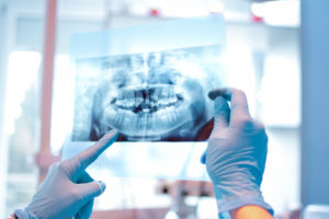 Will You Need Your Teeth X-Rayed at Your Next Dental Exam?