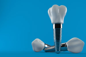 5 Reasons Dental Implants May Be the Best Choice to Replace Your Missing Tooth