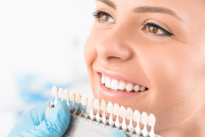 Get the Facts: Is Professional Tooth Whitening Really Worth the Cost?