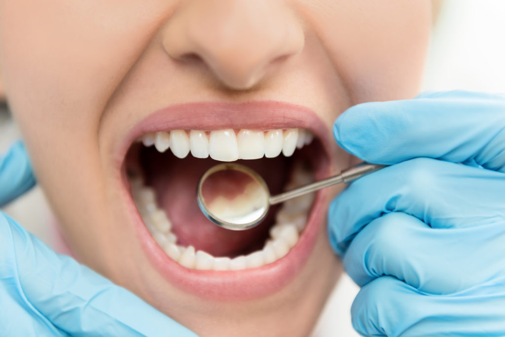 Worried About Enamel Loss? Follow These Tips to Keep Your Enamel