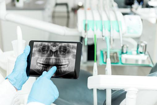 What exactly is digital dentistry, and how does it improve my dental care?