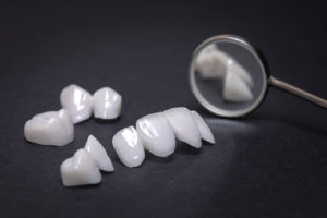 Seven reasons why you should consider a dental crown