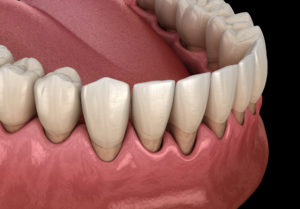 Following These Simple Tips Could Help You Significantly Reduce Your Chances of Getting Gum Disease Following These Simple Tips Could Help You Significantly Reduce Your Chances of Getting Gum Disease