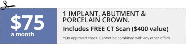 1 Implant, Abutment & Porcelain Crown