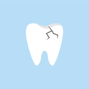 How Serious is a Chipped Tooth? Learn if it Requires Visiting Your Dentist 