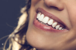 Teeth Whitening: Are You Getting Real Results or Just Covering Up a Bigger Problem?