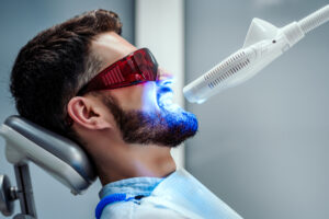 Essential Factors to Know Before You Decide to Move Forward with Teeth Whitening 