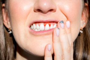 Learn the Best Tips That Can Help You Prevent Developing Gum Disease