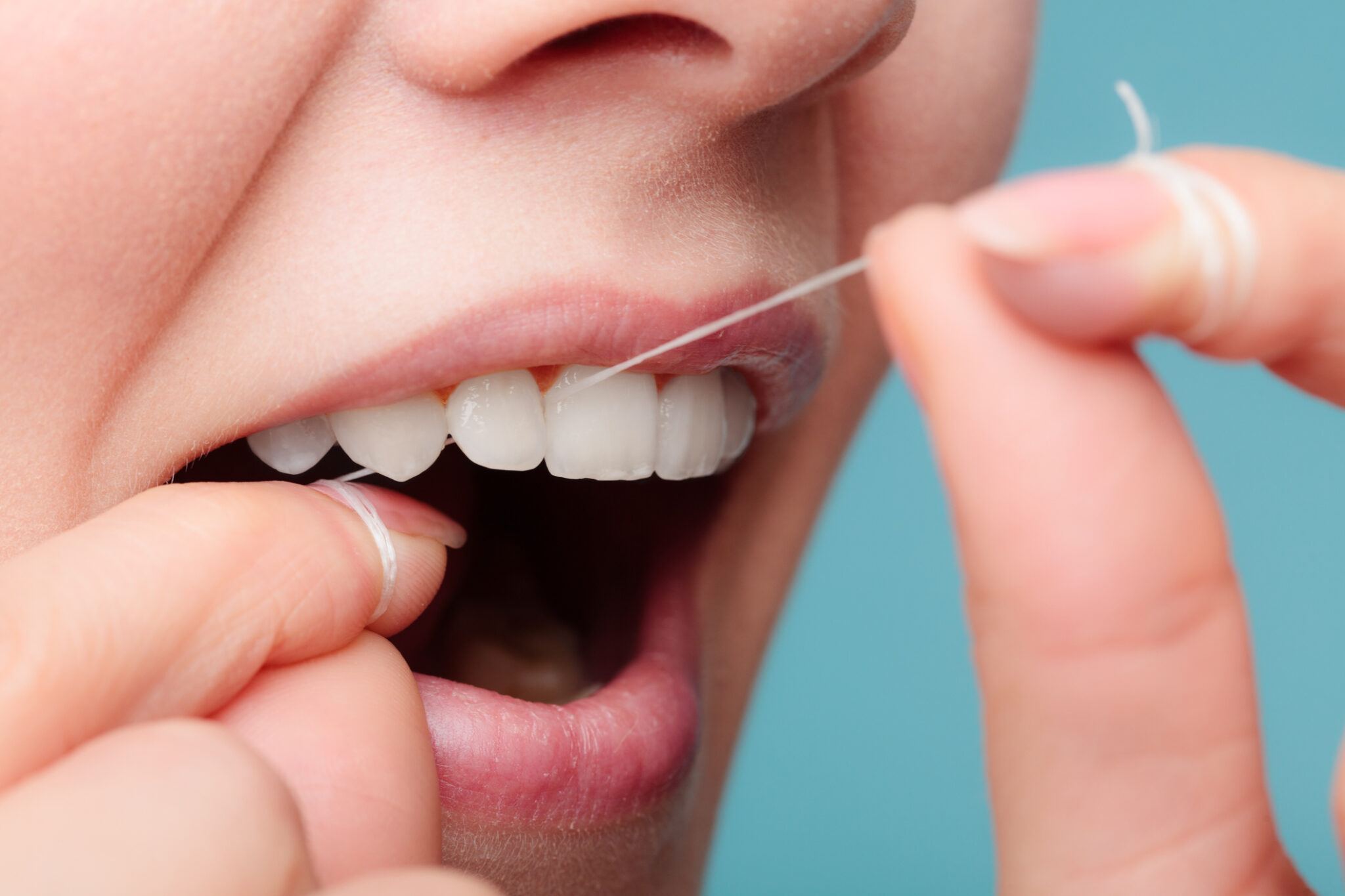 What Really Happens When You Don’t Floss Correctly? Learn the Serious Potential Consequences