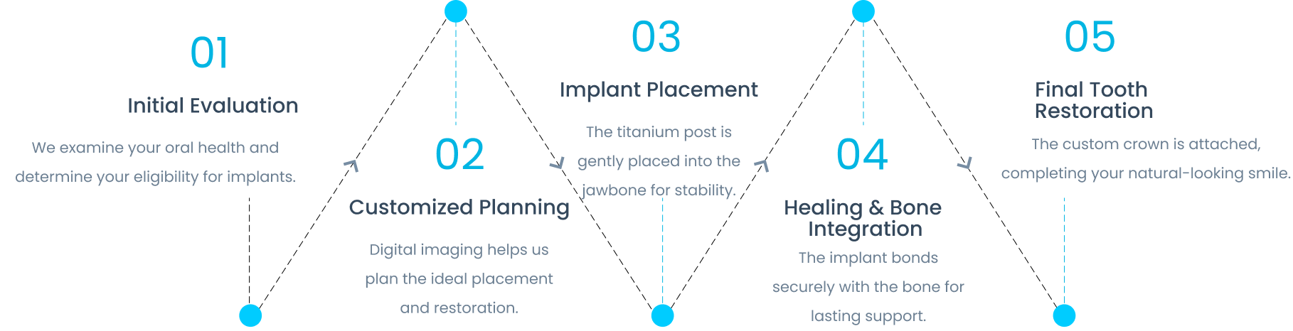 Dental Implant Timeline for South Gate Patients